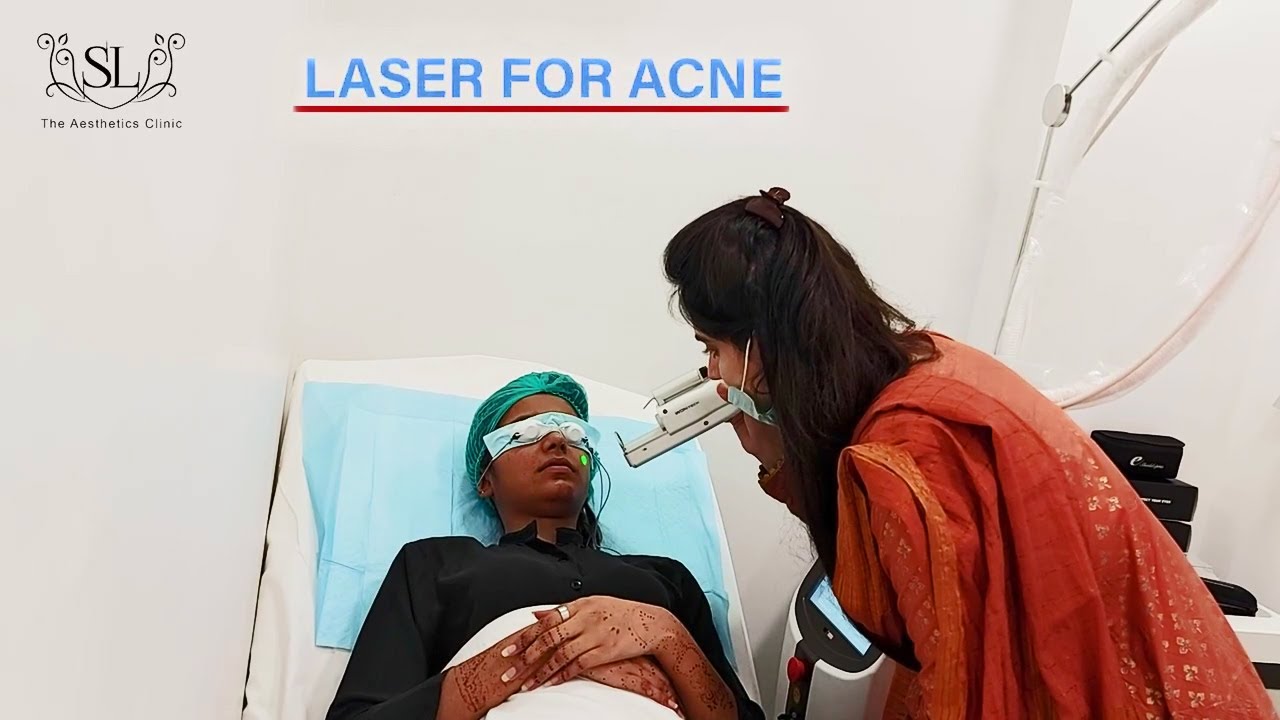Laser Treatment for Acne Scars at The Aesthetics Clinic Dr.  Shaista lodhi