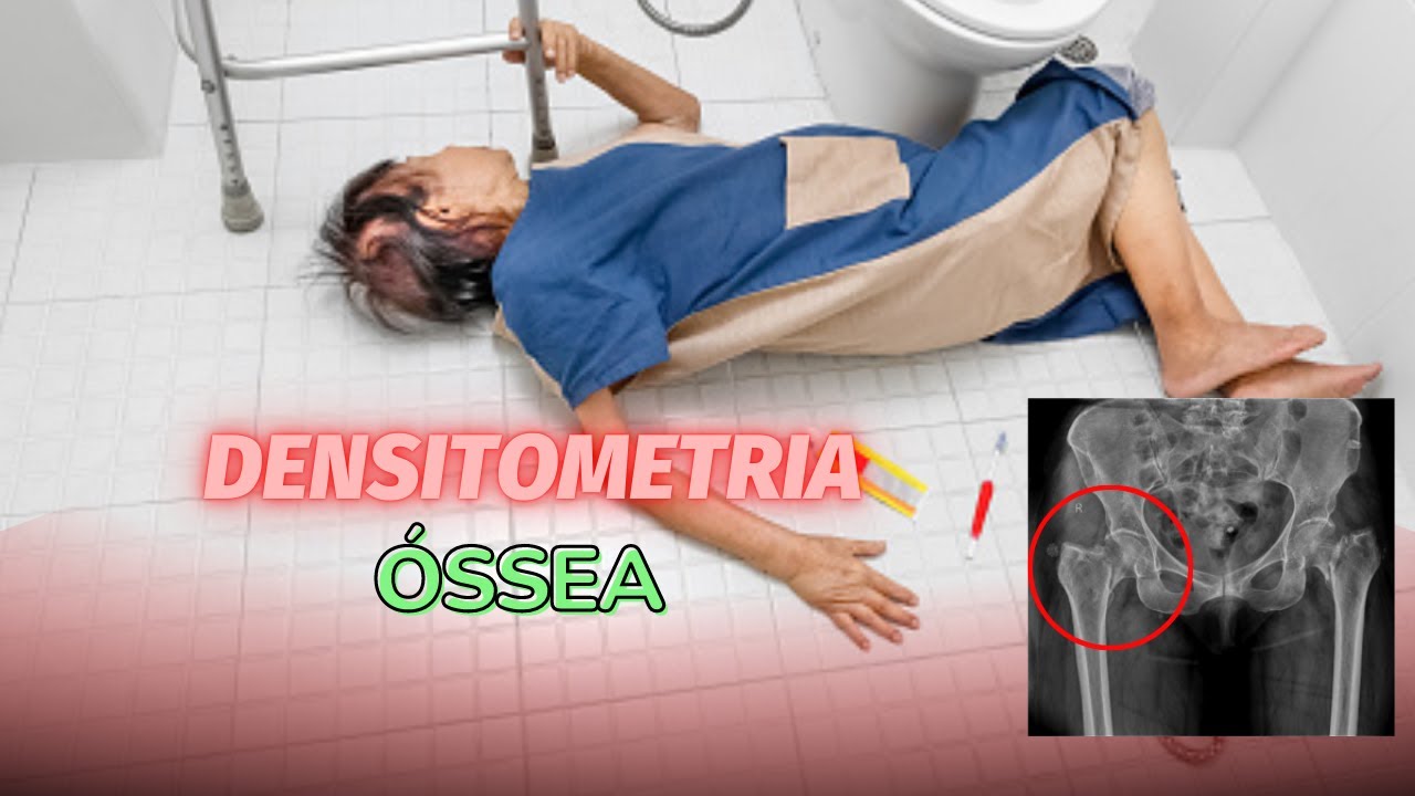 Como funciona a Densitometria Óssea | Radiologia Prática