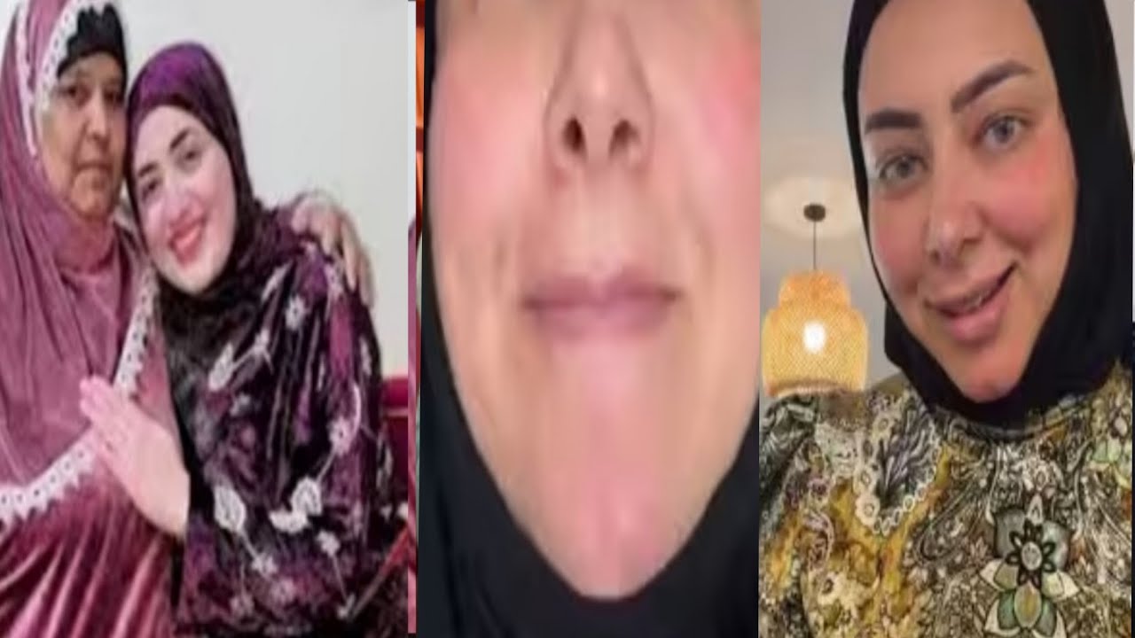 @ شروق علام القبض على دكتور التجمبل بعد تشويه وشها 😭حبى حياتك سر حذف فيديوهات حماتك 😱😱😱