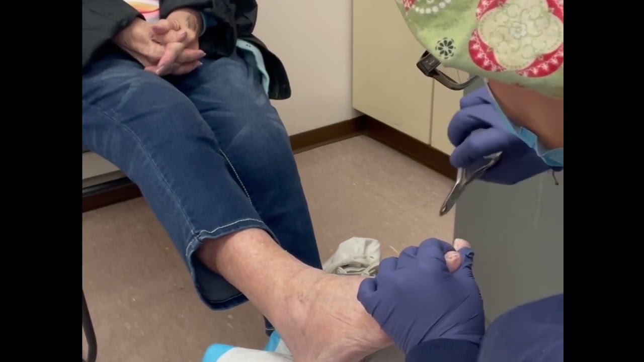 Normal foot care session