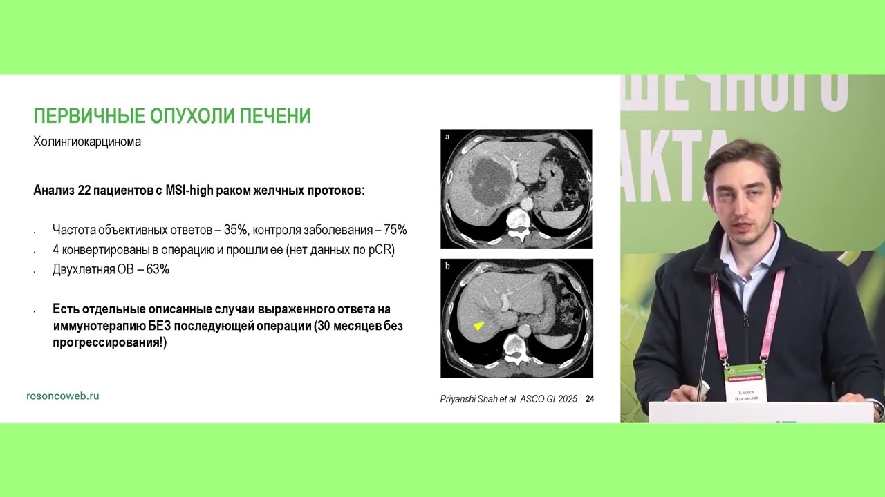 Возможности отказа от хирургии при опухолях ЖКТ, ассоциированных с MSI при полном клиническом ответе