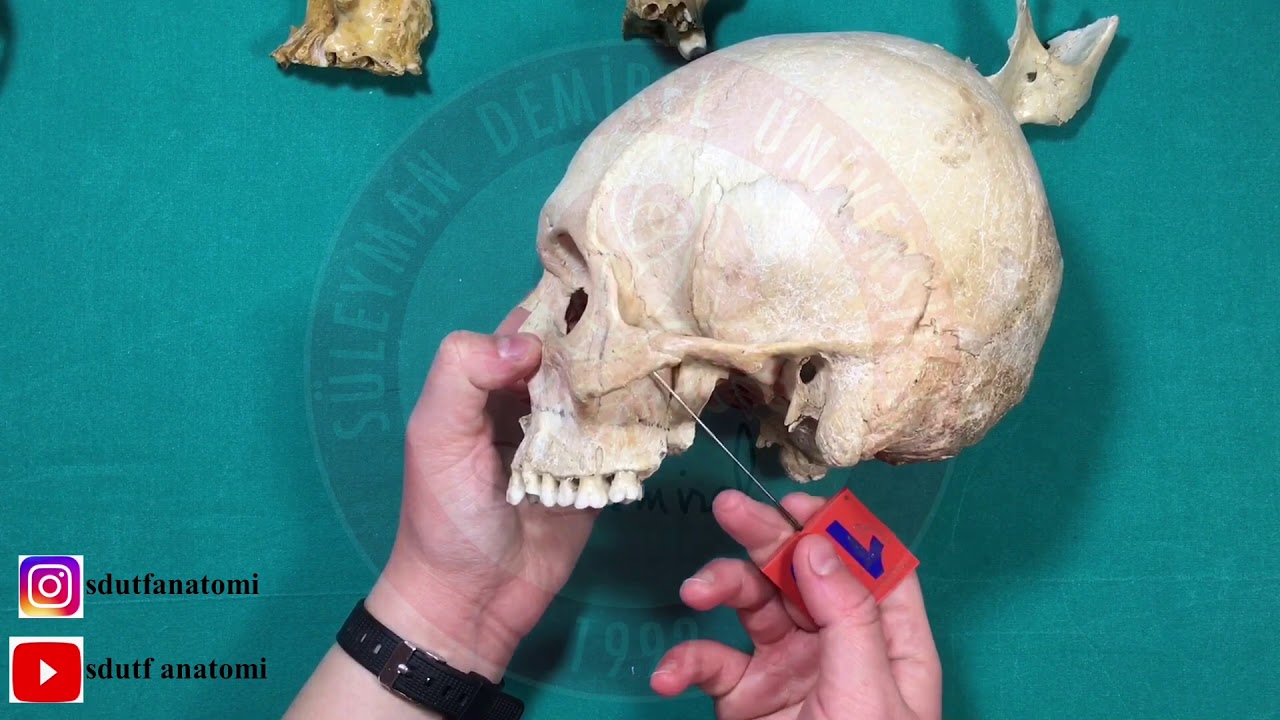 Maxilla