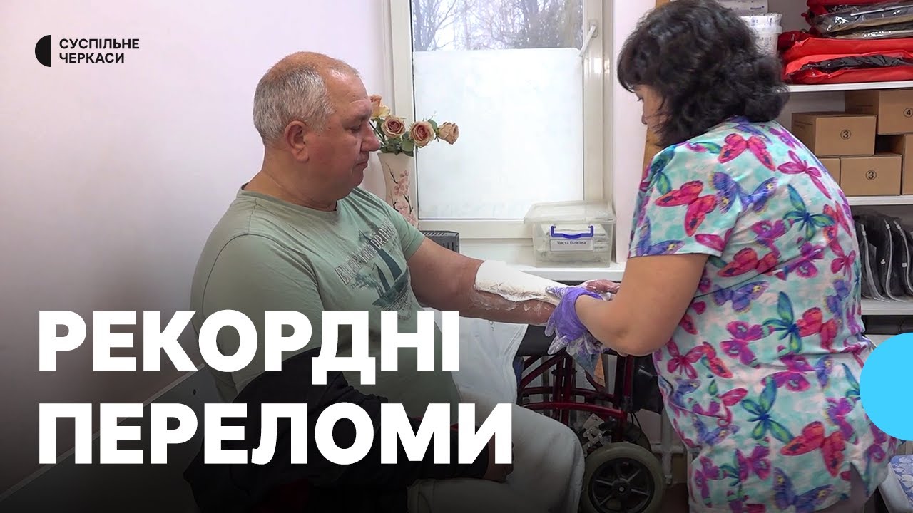 До черкаського травмпункту за добу звернулася рекордна кількість людей