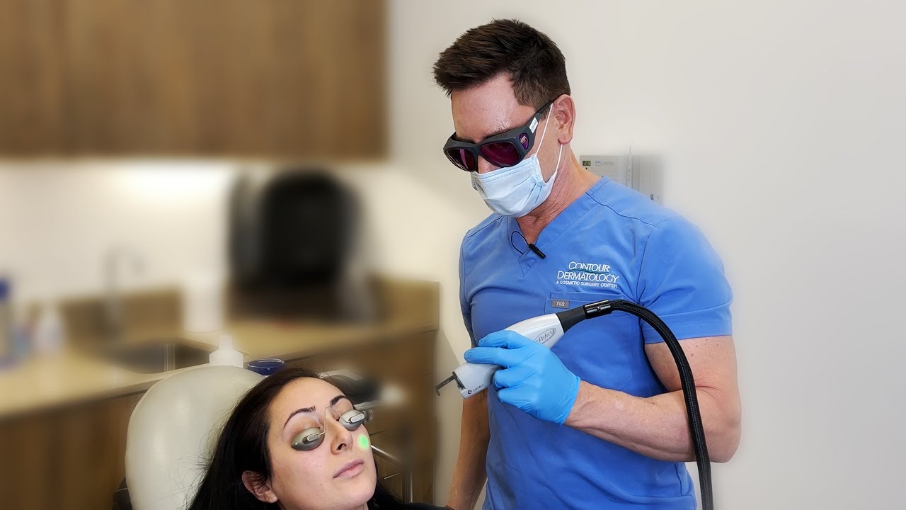 Vbeam Perfecta: Laser Treatment for Red Spots