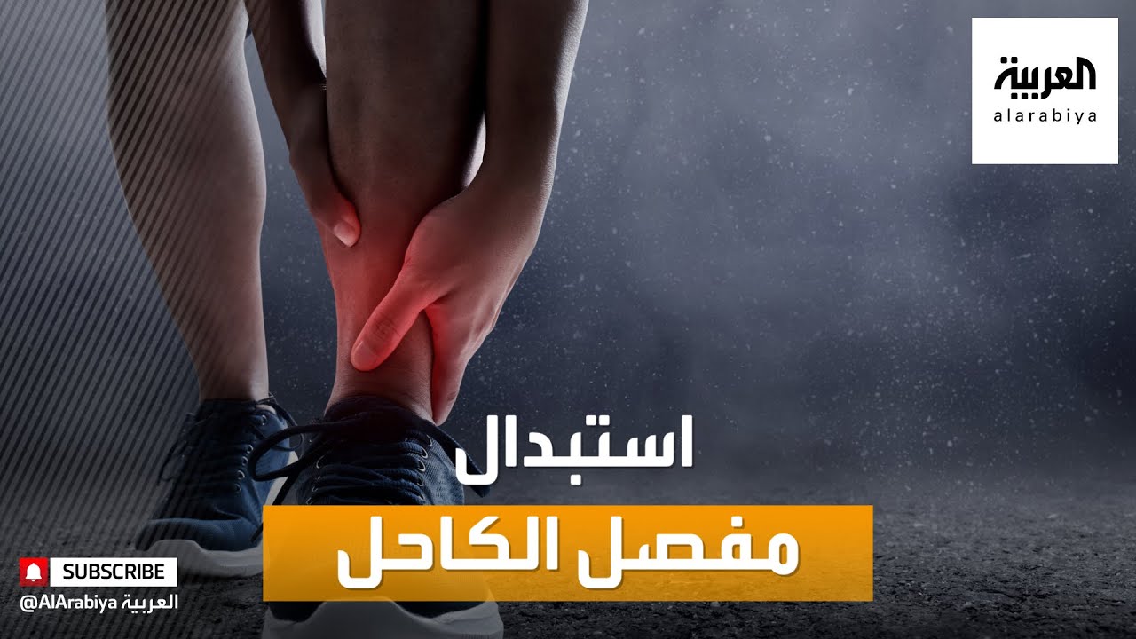 صباح العربية | متى نحتاج استبدال مفصل الكاحل ؟