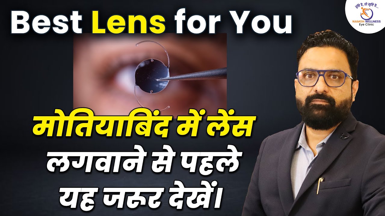 Best Lens for Cataract Surgery? 👁️ Eye Specialist Explains | Dr. S.S. Verma Eye Surgen