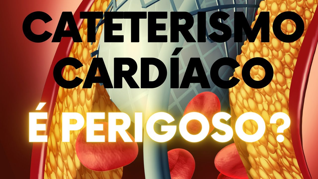 O CATETERISMO CARD&Iacute;ACO &Eacute; mesmo PERIGOSO?
