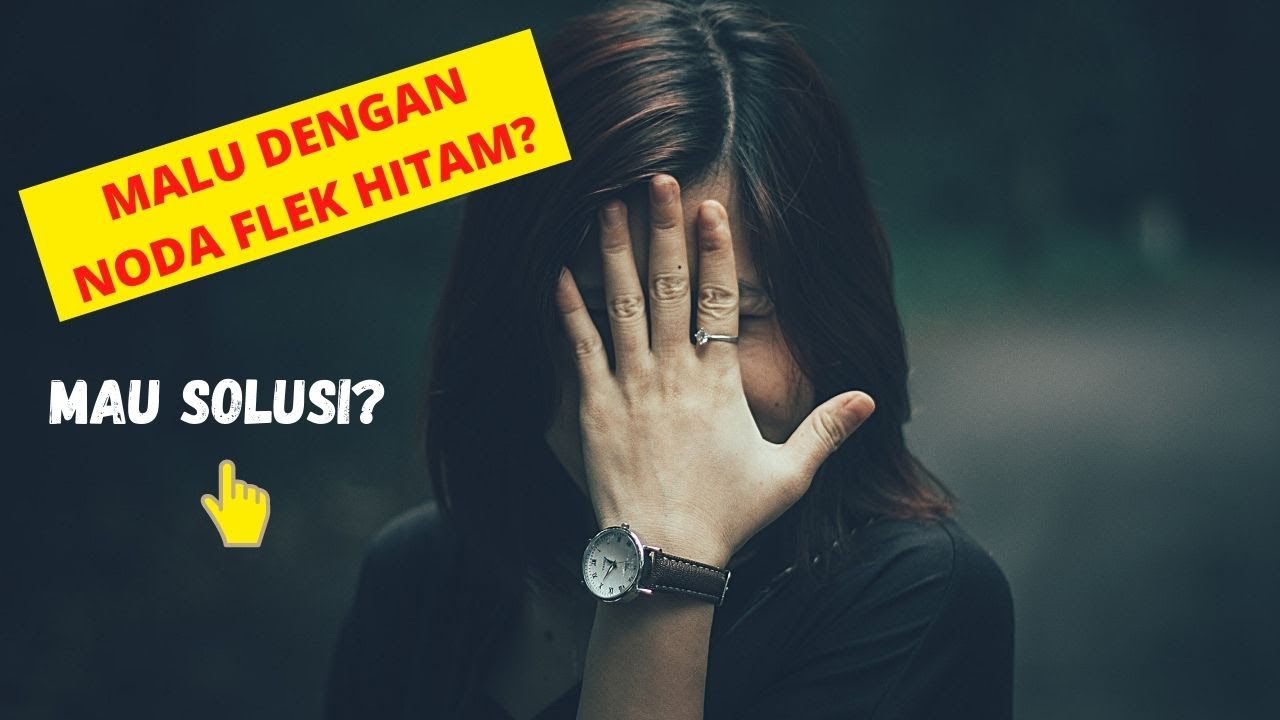 #flekhitam #nodahitam #wajahcerah TIPS CARA MUDAH MENGHILANGKAN FLEK HITAM