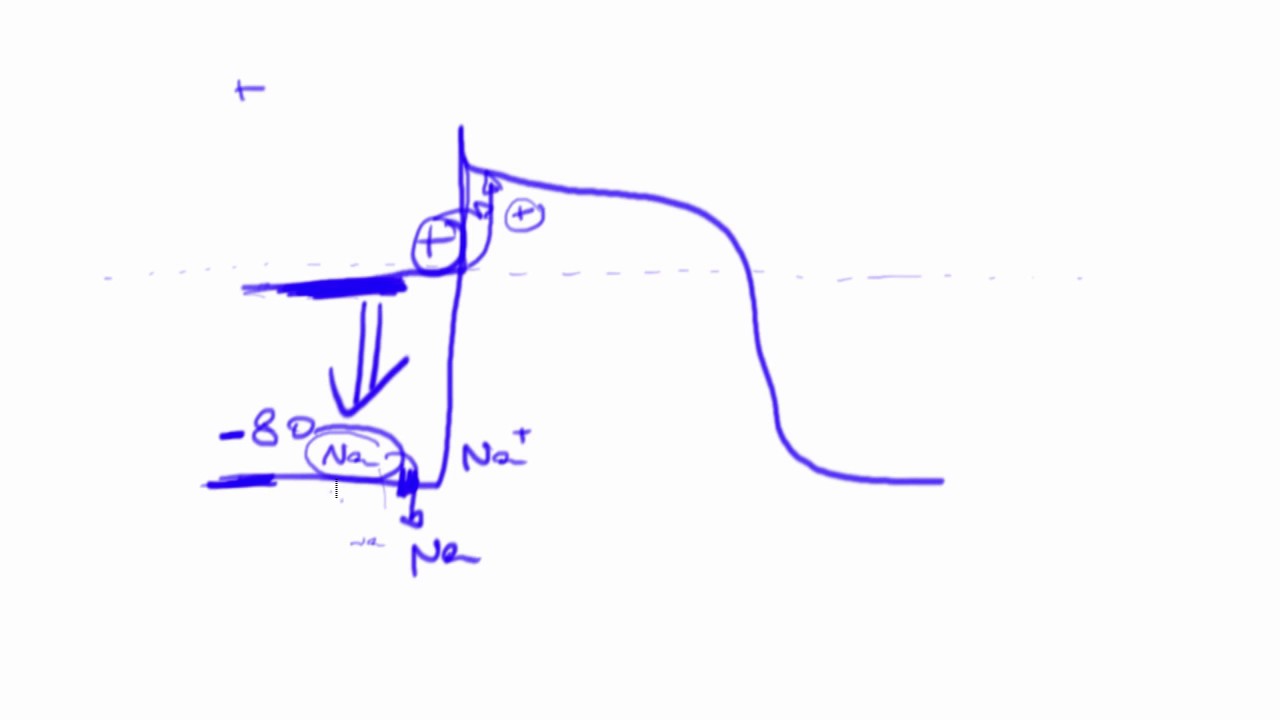 Effect of adenosine on pulmonary vein isolation with radiofrequency ablation for atrial fibrillation