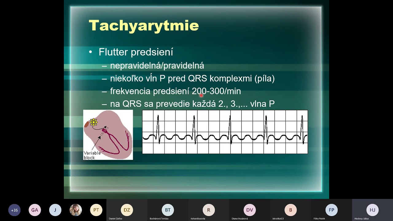 SCOME EKG webinár časť druhá