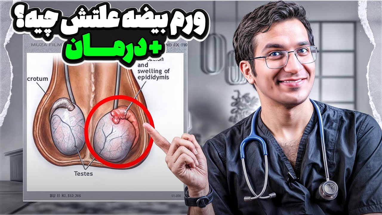 علت ورم بیضه چیست؟ ۴ درمان ورم بیضه
