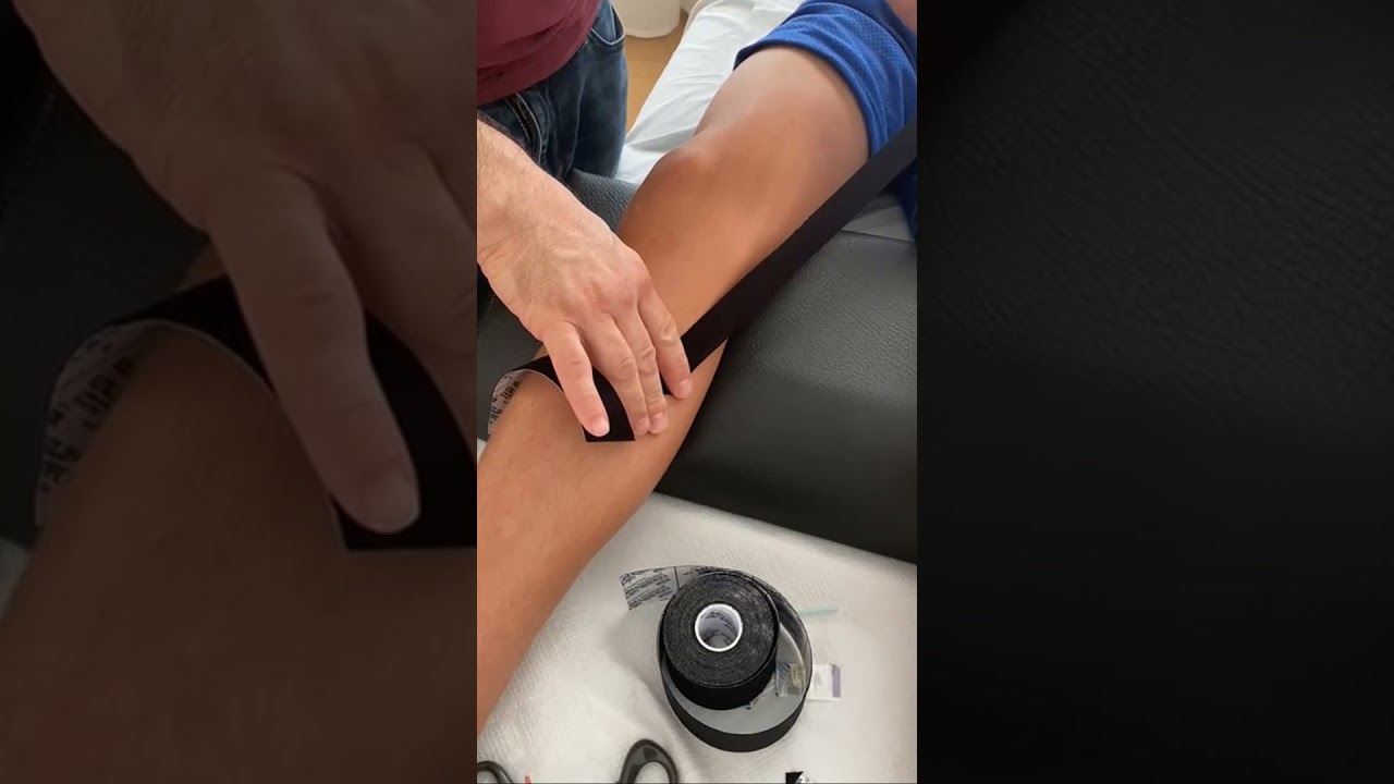 קינזיוטייפ לכאבים בברך פס אנסרינוס בורסיטיס - הדגמה