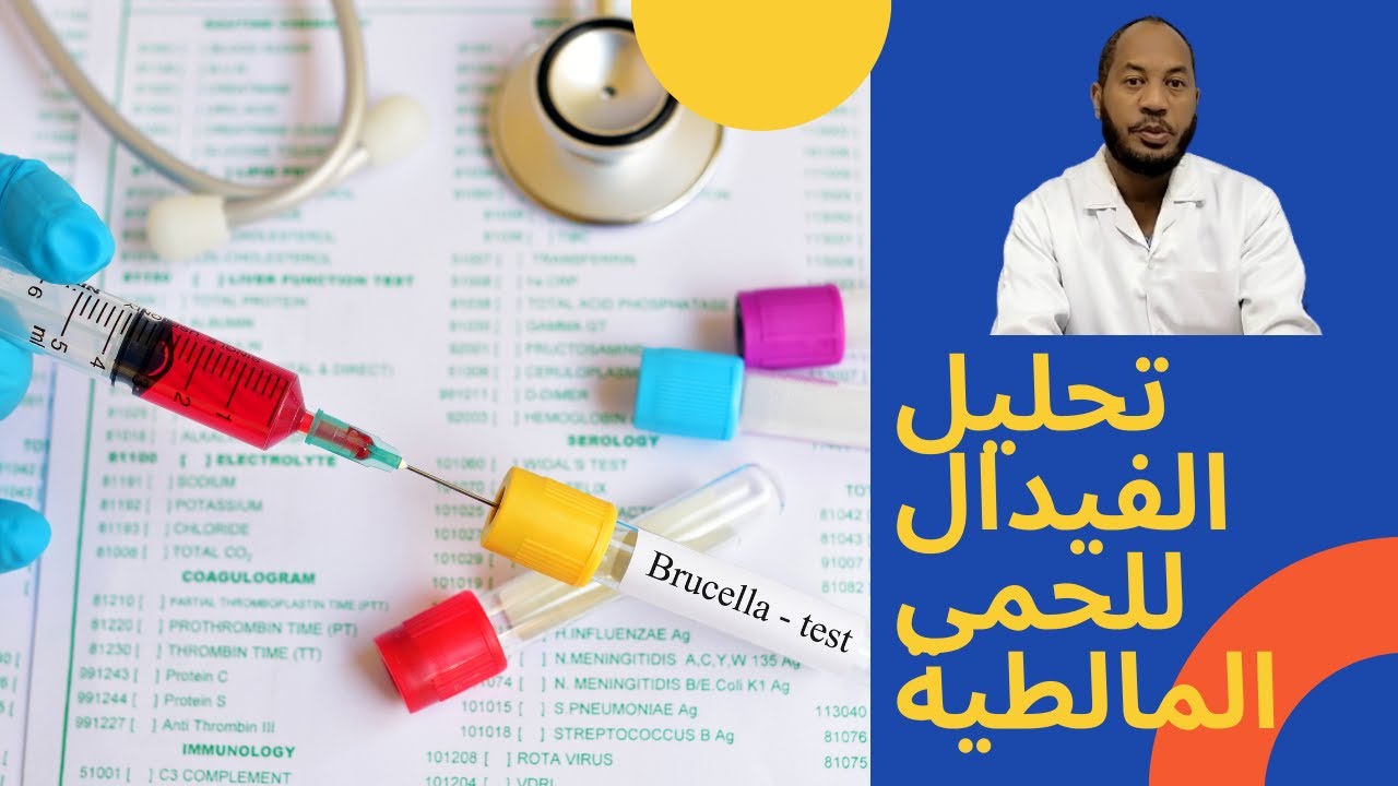 تحليل الحمى المالطية بالامصال (الفيدال)