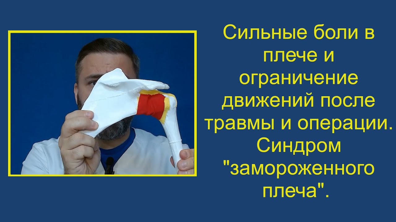 Сильные боли в плече и ограничение движений после травмы и операции. Синдром 