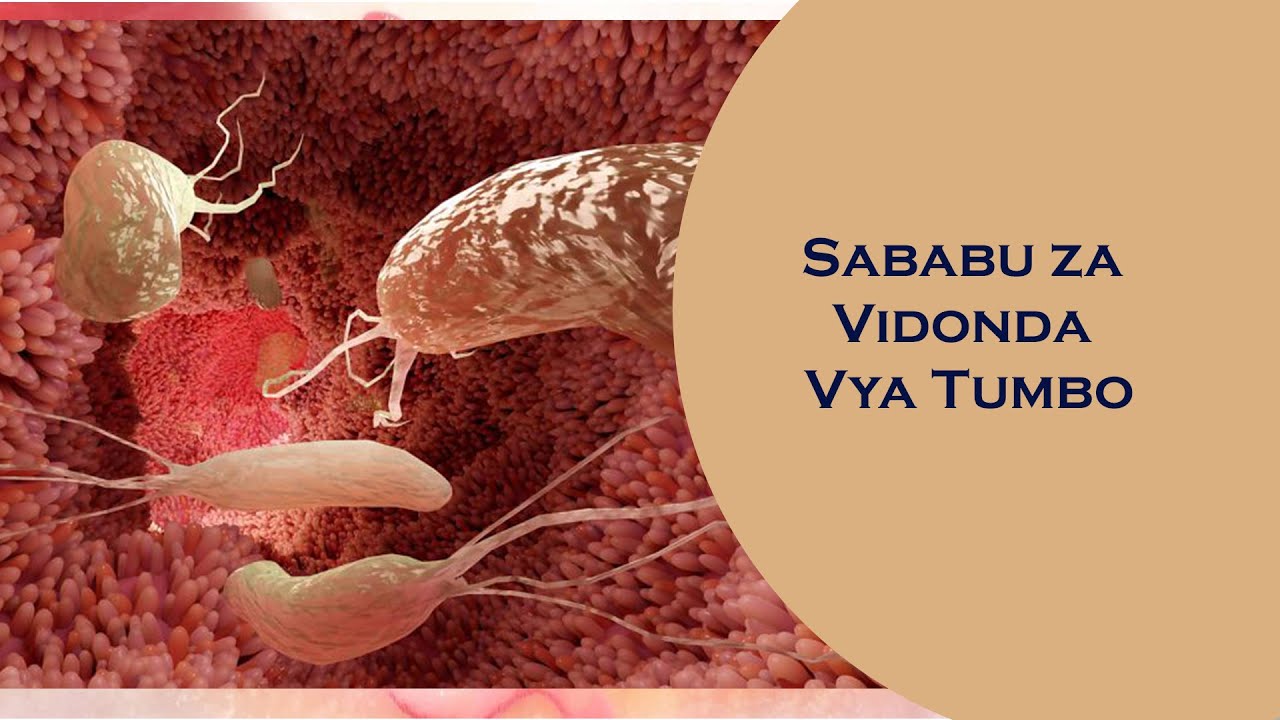 AFYA TIPS: SABABU ZA VIDONDA VYA TUMBO
