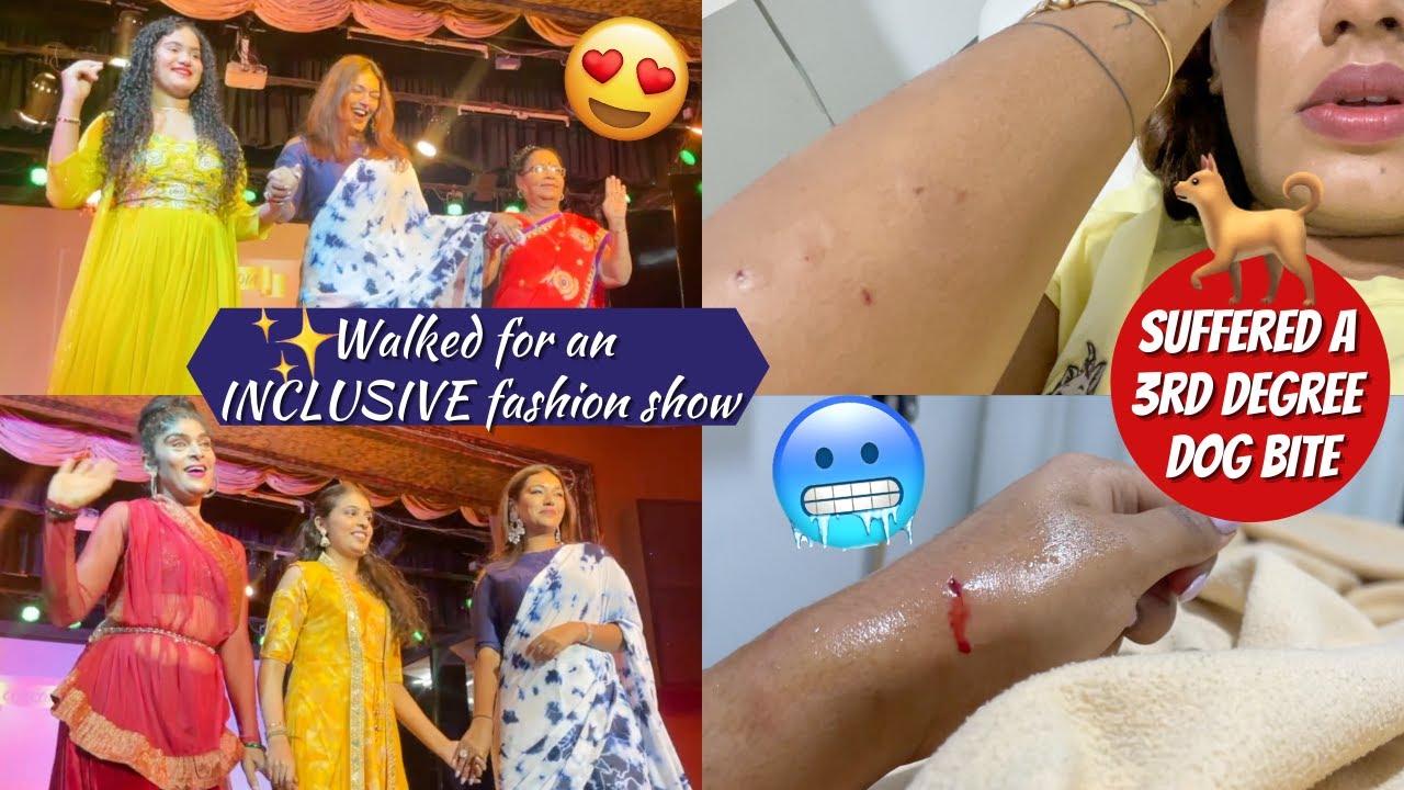 Fashion Show & THEN A Third degree DOG BITE! Traumatic Week in my life! #HustleWSar