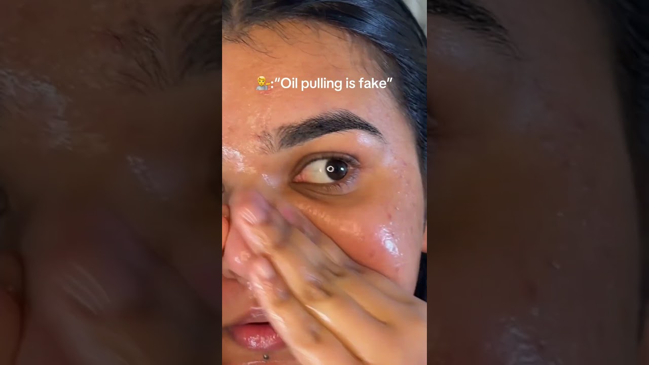 Oil pulling is fake but no see what happens when you pull out your blackhead 