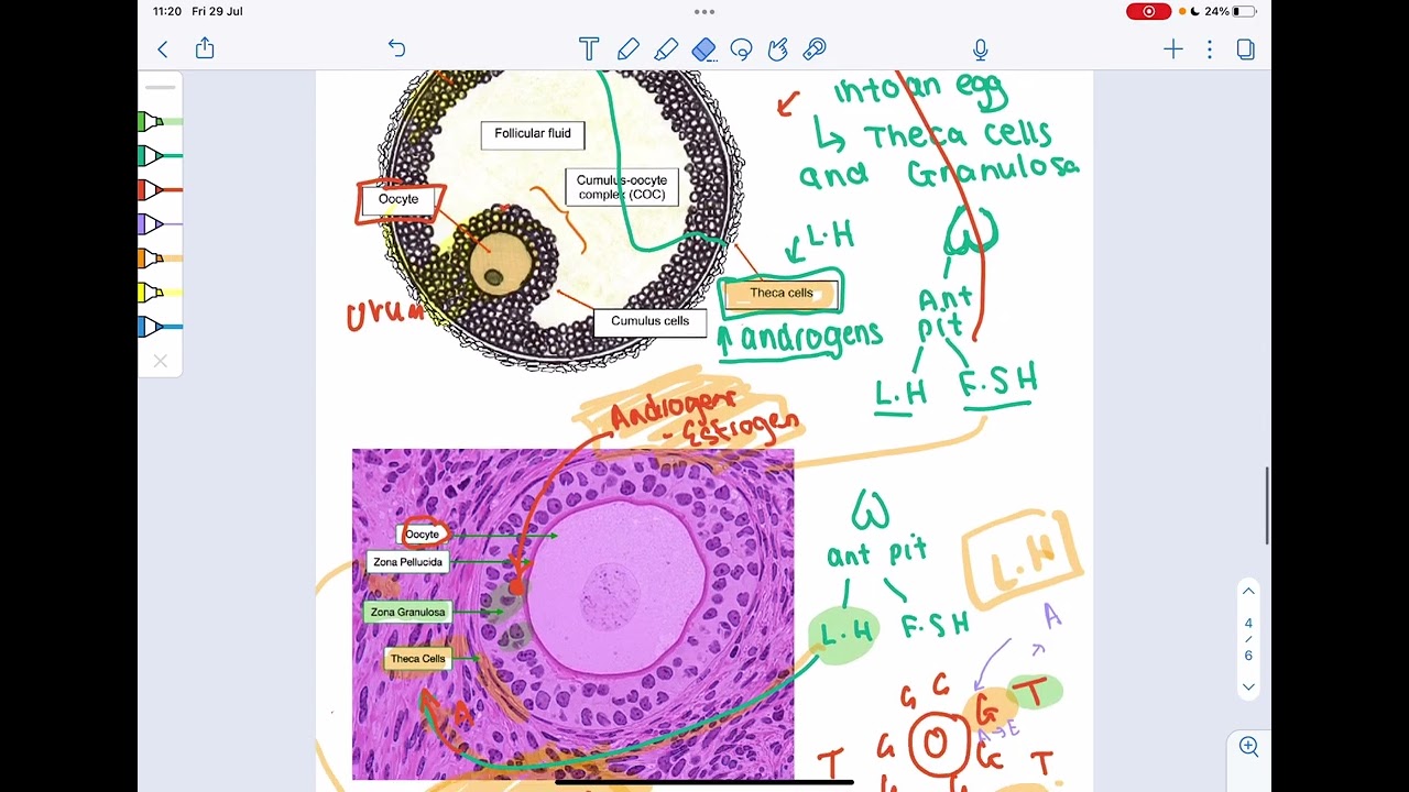Pathophysiology of Polycystic Ovarian Syndrome, what happens to the ovarian follicles?