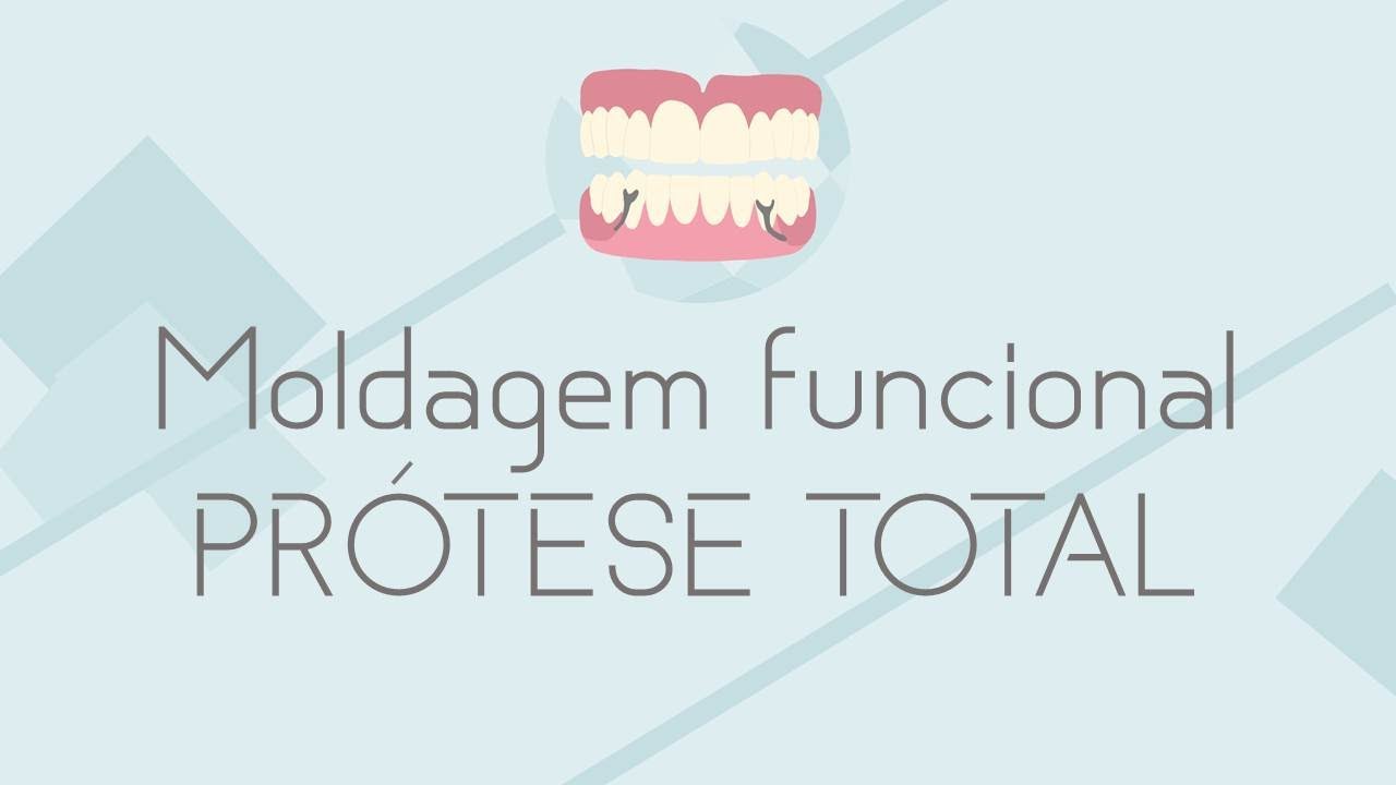 SEQUÊNCIA CLÍNICA Moldagem Funcional Propriamente Dita do Arco Superior com Elastômero (PT)