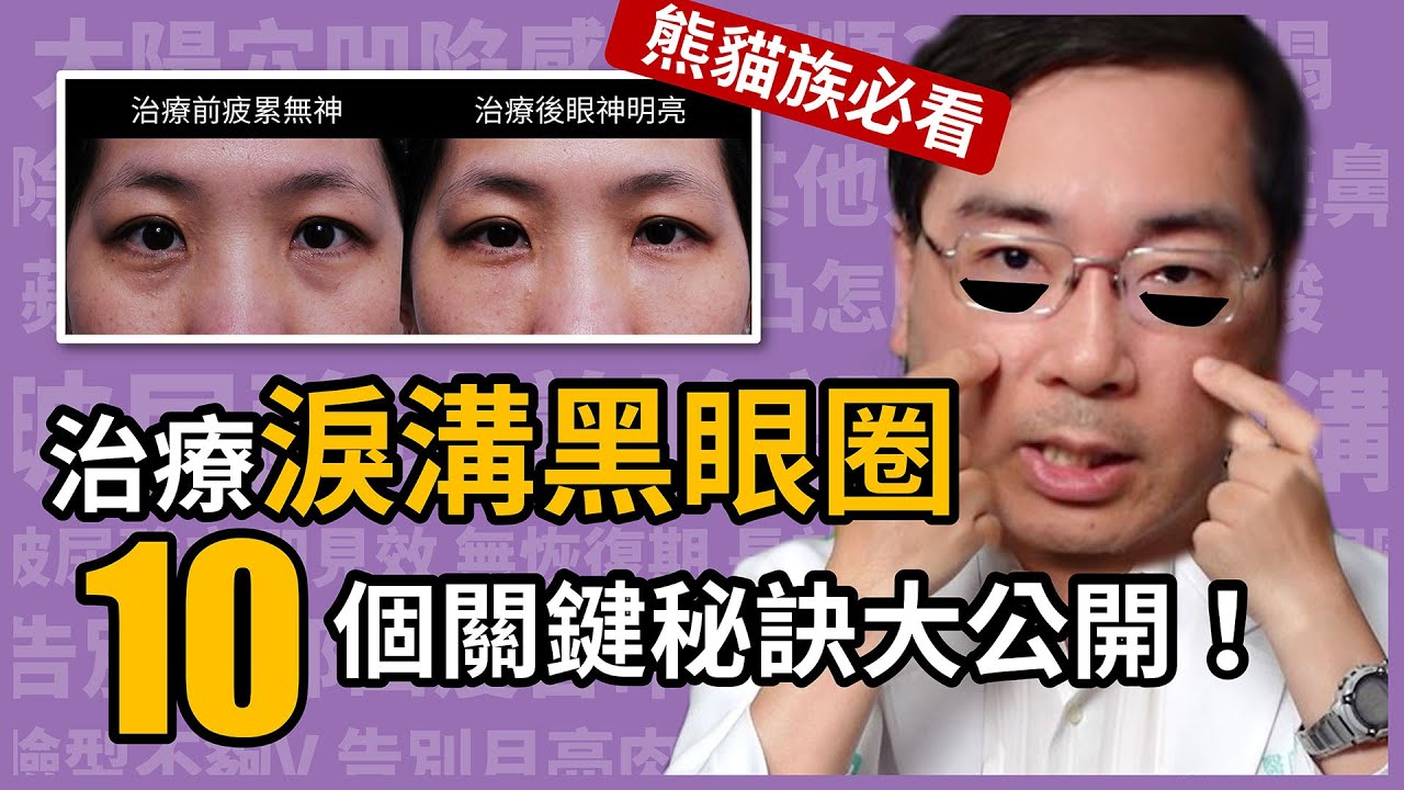 治療淚溝型黑眼圈，10個關鍵秘訣大公開！林政賢醫師讓你擺脫疲累感。