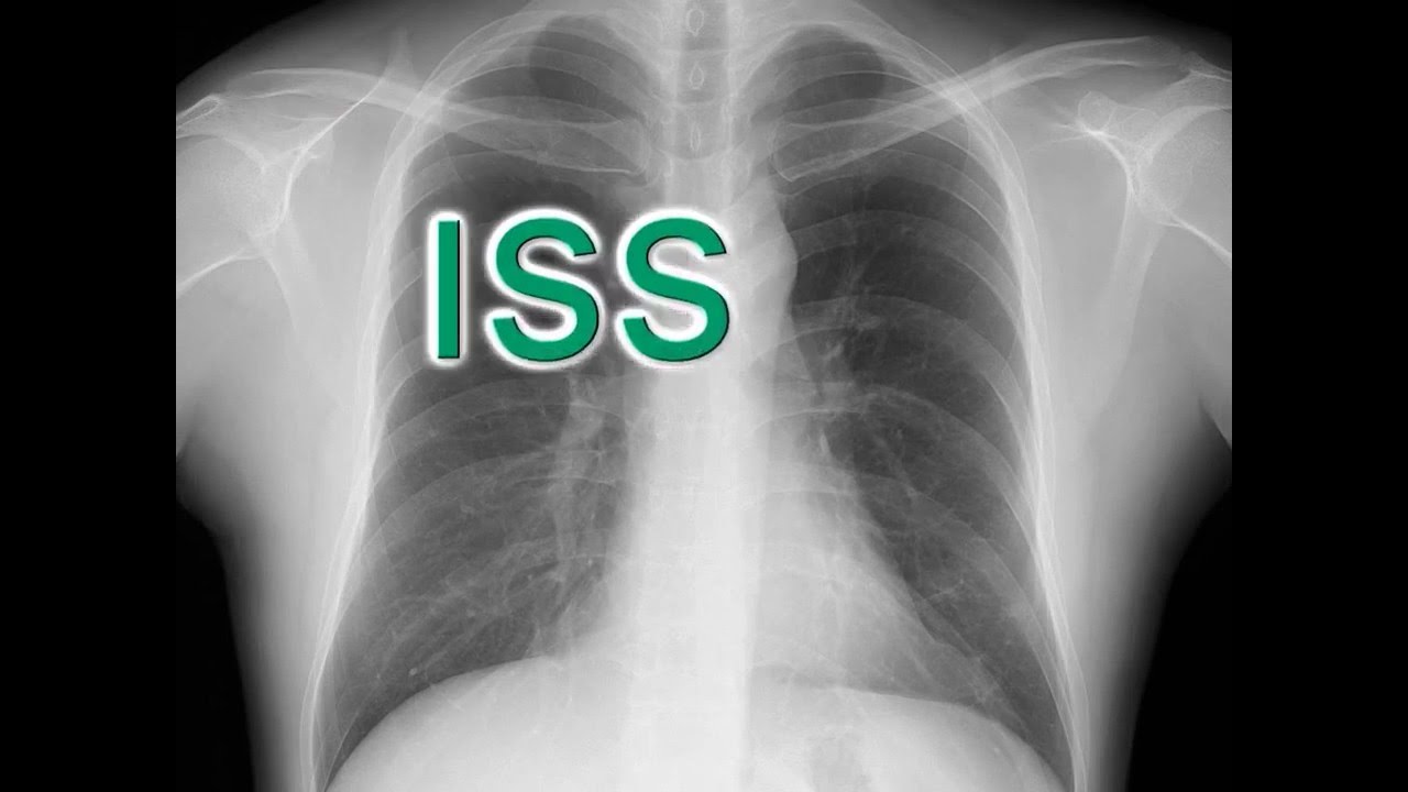 Fujifilm's very own GOS+ISS Technology