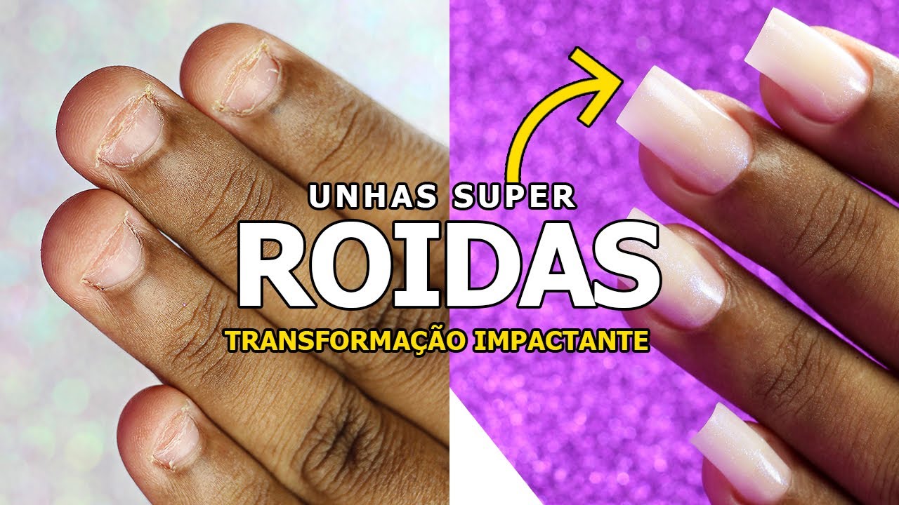FIBRA DE VIDRO EM UNHAS ROÍDAS (IMPRESSIONANTE)