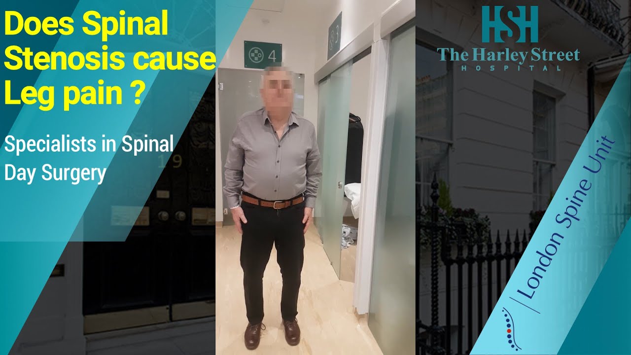 Does Spinal Stenosis cause Leg pain ?