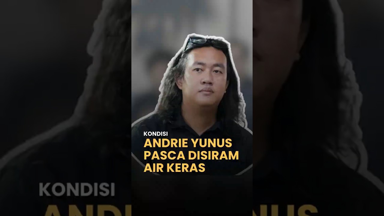 Kondisi Andrie Yunus Pasca Disiram Air Keras‼️