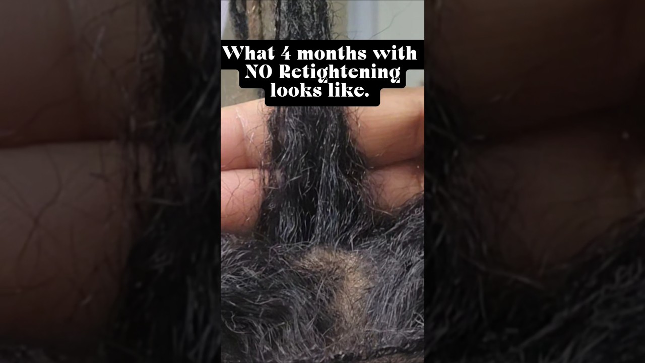 4 Months NO Retie: The Good, The Bad & The Ugly 😱