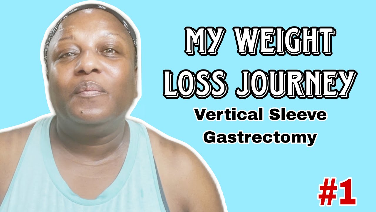 My Weight-loss Journey. Vertical Sleeve Gastrectomy.  #1