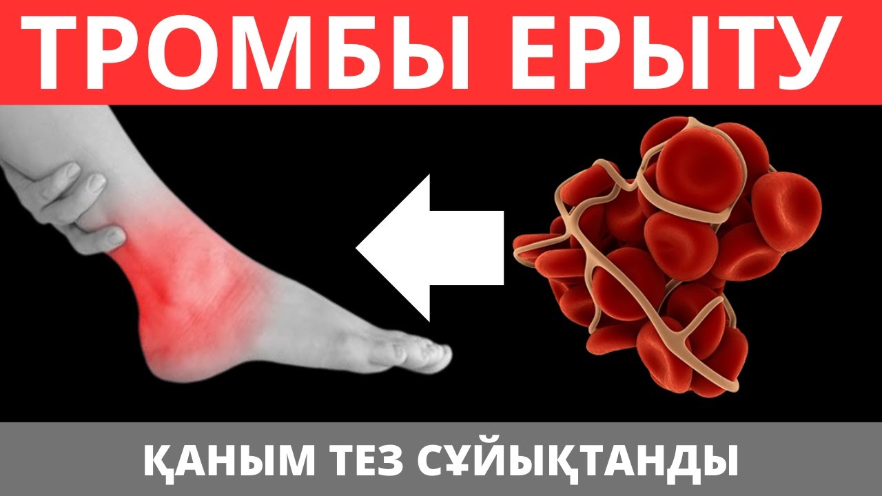 Қантамырдағы Ұйыған ҚАНДЫ тез ерітетін ТОП 5 тағам. Қан тамыр аурулары