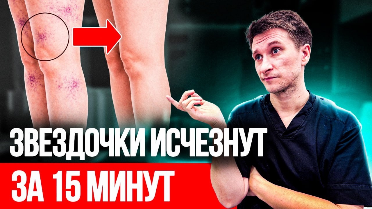 Средство №1 от сосудистых сеточек! Врач рекомендует это.