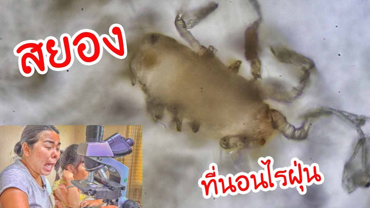 น้องถูกใจ | สยองที่นอนไรฝุ่น