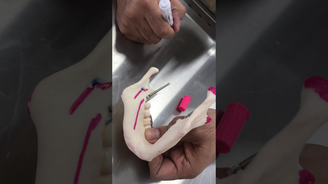 Mandible