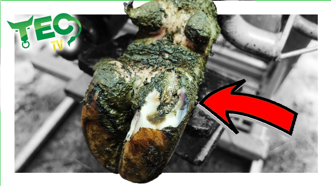 LARGE GAPING INFECTED HEEL | TEC TV