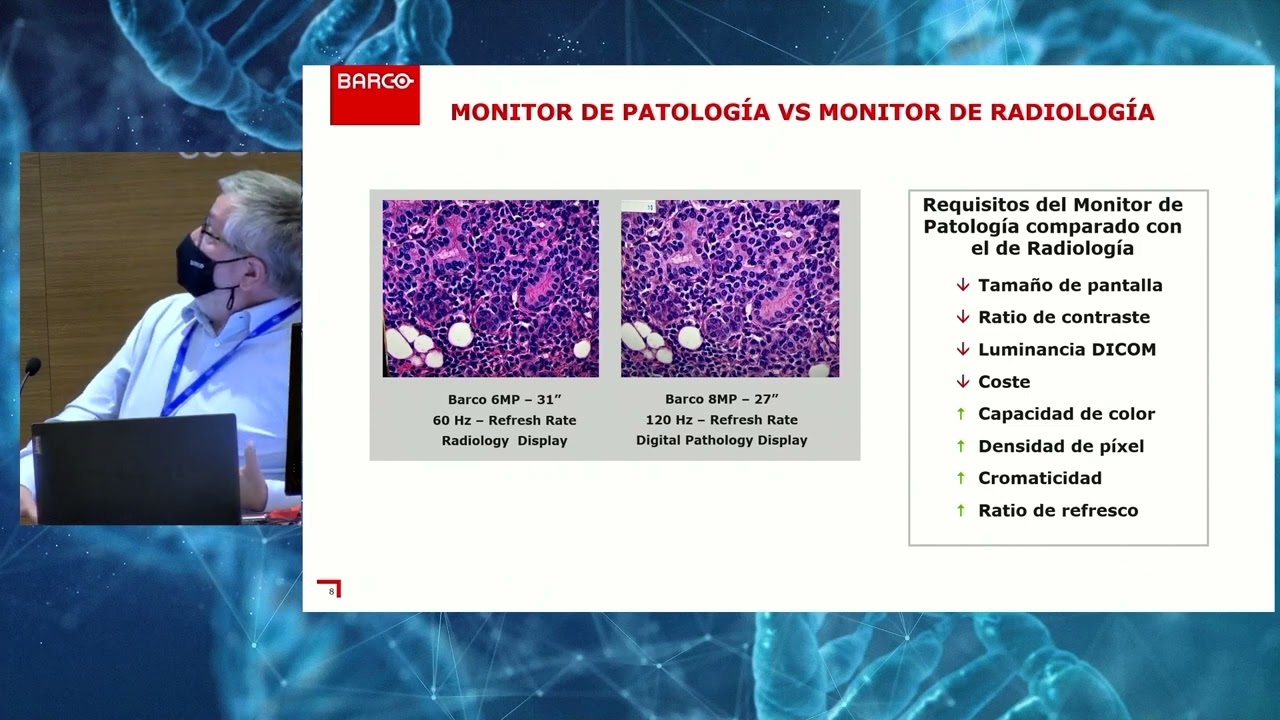 La importancia del monitor en diagn&oacute;stico en patolog&iacute;a digital.