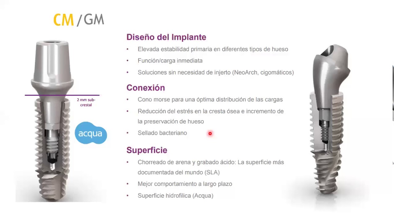 Bases del Sistema Neodent Pt.2