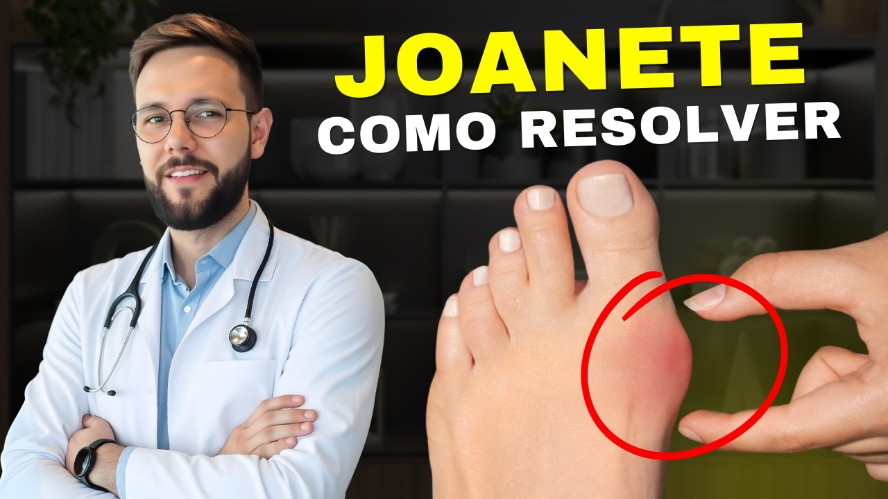 Joanete: Tratamento Caseiro que Realmente Resolve!