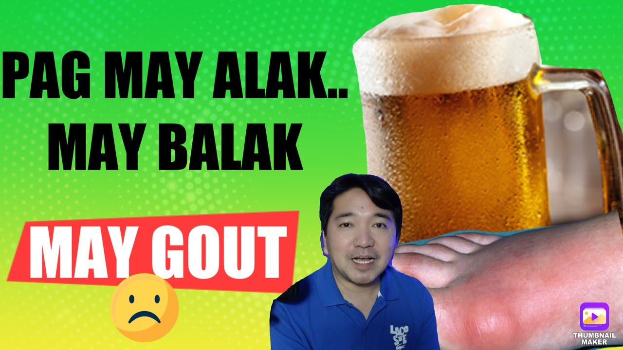 PUEDE ba ang BEER at RED WINE sa MATAAS na URIC?