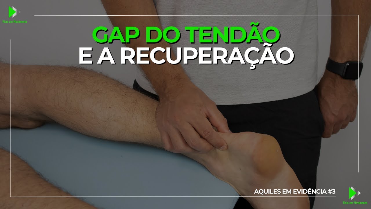 A influência do local da ruptura e da distância do GAP na ruptura aguda do tendão de Aquiles