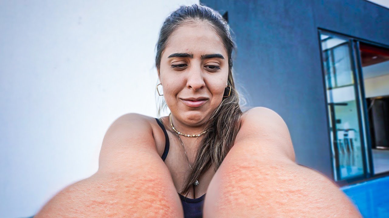DESCOBRI QUE TENHO UMA ALERGIA MUITO SÉRIA!!