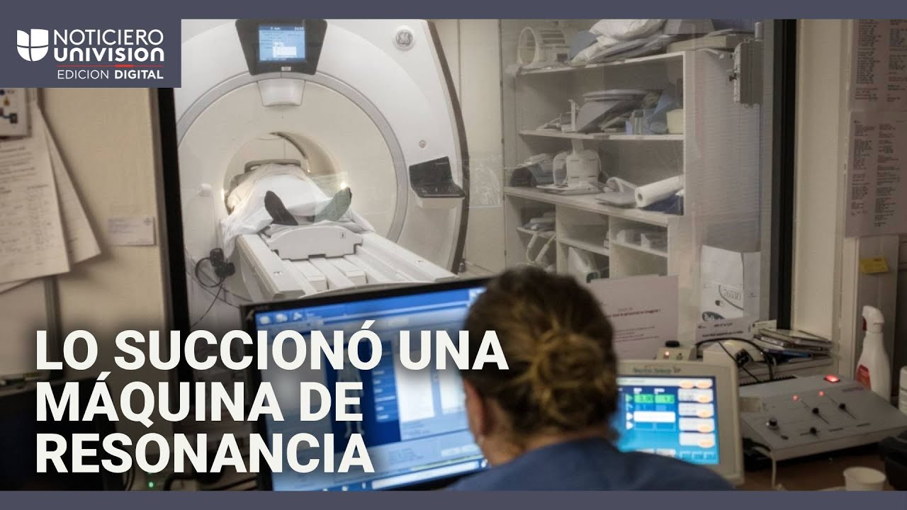 Un hombre muere tras ser succionado por máquina de resonancia magnética: llevaba una cadena metálica