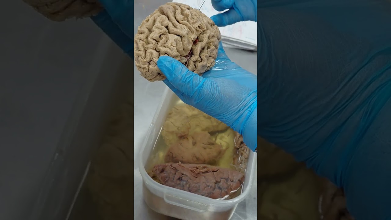 Cerebro 2