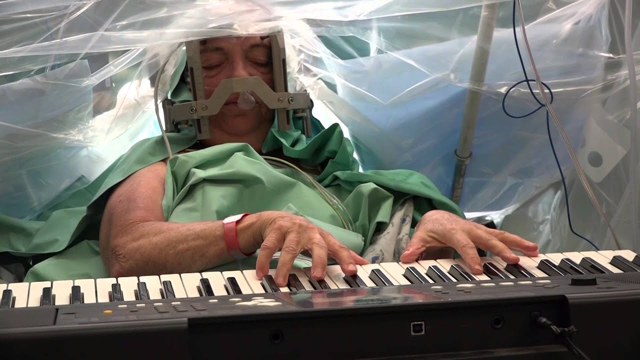 ניתוח DBS לחולת פרקינסון- פרופ' פריד וד