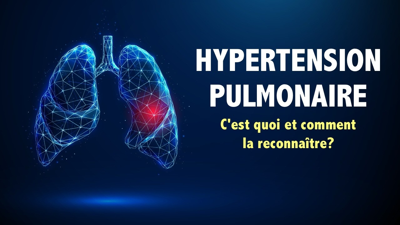 C’est quoi l’hypertension pulmonaire, et comment on peut savoir si on en fait?
