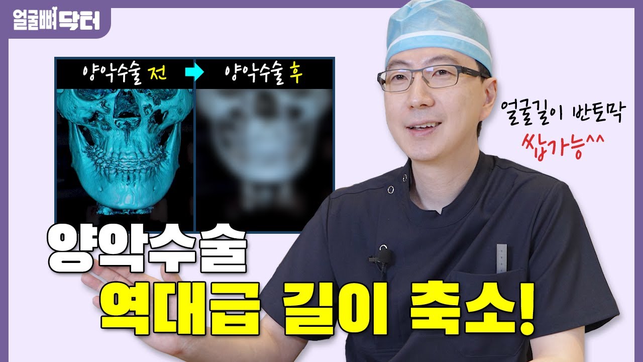 양악수술로 역대급 길이 축소!!! 얼굴 반토막 가능? ㅇㅇ 쌉가능^^