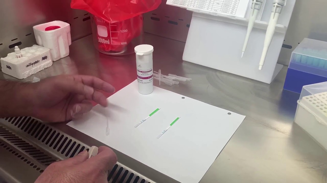 Demo finger prick testing Biocan COVID19 Ab Rapid Test