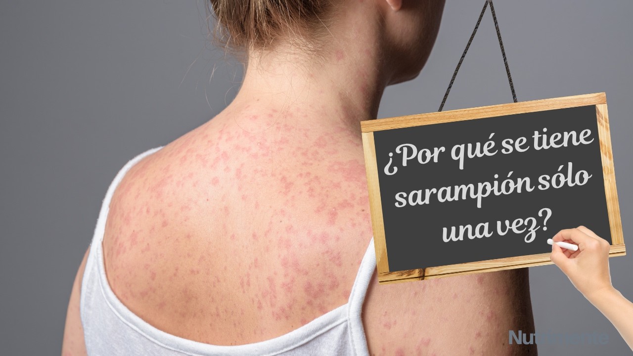 Sarampión: Memoria Inmunológica y Vacunas