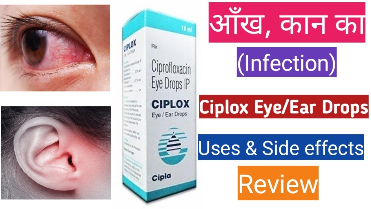 Ciplox Eye/Ear drops uses in hindi | Ciplox Eye Drops in hindi | Ciplox Ear Drops in hindi