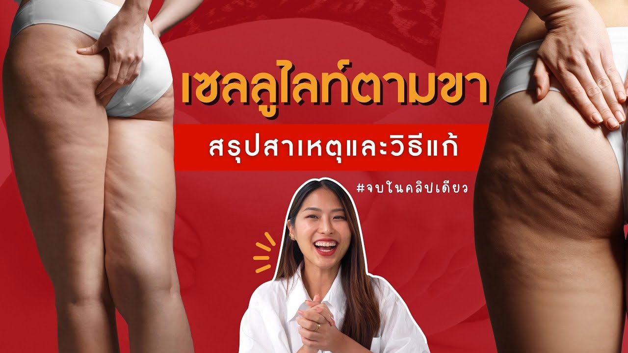 แก้ปัญหาเซลลูไลท์ ผิวเปลือกส้ม แบบไม่เสียเงินสักบาท‼️